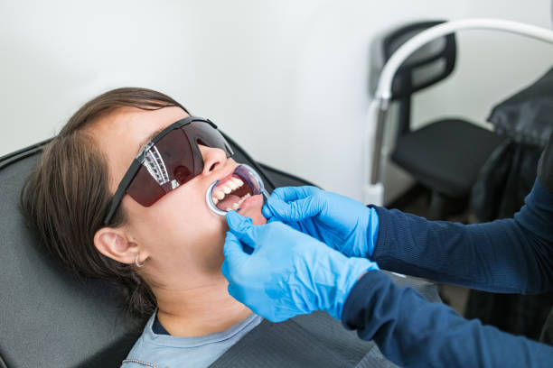 Best Knocked-Out Tooth (Avulsed Tooth) Treatment in Jennings, LA