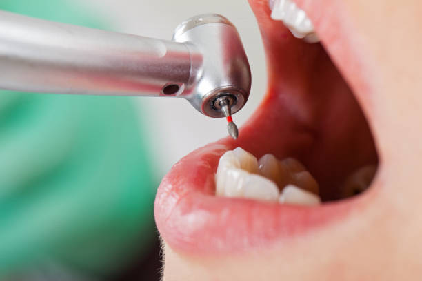 Best Emergency Treatment for Oral Infections in Jennings, LA
